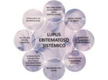 Sintomas del Lupus